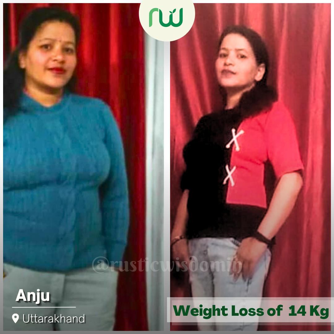 Anju