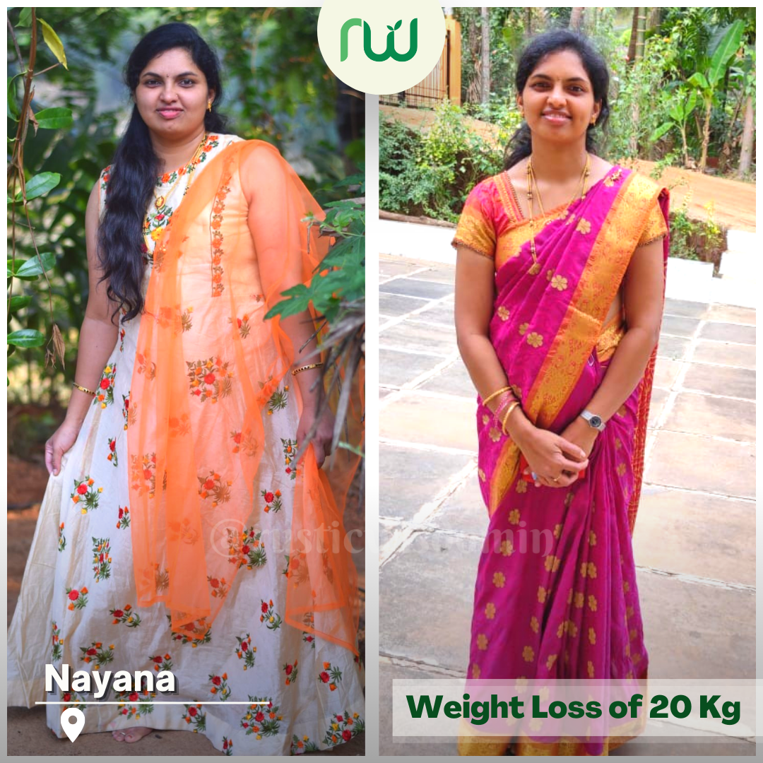 Nayana